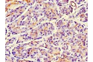 Immunohistochemistry of paraffin-embedded human pancreatic tissue using ABIN7159746 at dilution of 1:100 (MAP1 抗体  (AA 401-600))