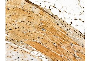 Phospho-VEGFR3 (Tyr1230) Antibody at 1/100 staining Rat skin tissue by IHC-P. (FLT4 抗体  (pTyr1230))