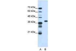 PCBP1 antibody used at 1. (PCBP1 抗体)