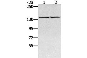 Western Blot analysis of Hela and hepg2 cell using RGS22 Polyclonal Antibody at dilution of 1:400 (RGS22 抗体)