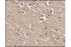 Immunohistochemistry of Slitrk1 in human brain tissue with this product at 2. (SLITRK1 抗体  (C-Term))