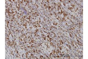 Immunostaining (ISt) image for anti-RAB27A, Member RAS Oncogene Family (RAB27A) (AA 122-221) antibody (ABIN562560)