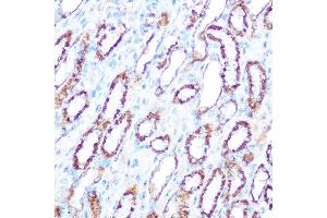 Immunohistochemistry (IHC) image for anti-Nitric Oxide Synthase 2, Inducible (NOS2) (AA 500-730) antibody (ABIN6144728)