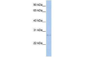 WB Suggested Anti-MDM1 Antibody Titration:  0. (MDM1 抗体  (N-Term))