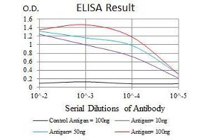 Black line: Control Antigen (100 ng), Purple line: Antigen(10 ng), Blue line: Antigen (50 ng), Red line: Antigen (100 ng), (ASS1 抗体)