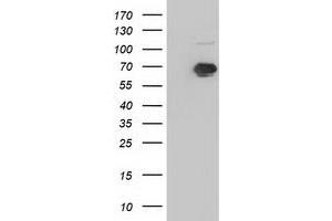 Western Blotting (WB) image for anti-Insulin-Like Growth Factor 2 mRNA Binding Protein 2 (IGF2BP2) antibody (ABIN1498825) (IGF2BP2 抗体)