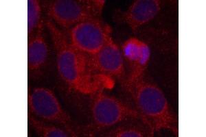Immunofluorescence staining of methanol-fixed MCF cells using Phospho-KDR-Y1175 antibody.