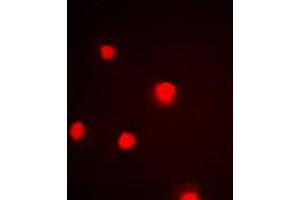 Immunofluorescent analysis of p53 (pS392) staining in HeLa cells. (p53 抗体  (C-Term, pSer392))