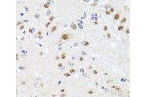 Immunohistochemistry (Paraffin-embedded Sections) (IHC (p)) image for anti-Centrin, EF-Hand Protein, 3 (CETN3) antibody (ABIN7264157)