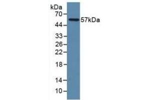 Detection of Recombinant LAMP1, Human using Polyclonal Antibody to Lysosomal Associated Membrane Protein 1 (LAMP1) (LAMP1 抗体  (AA 49-297))