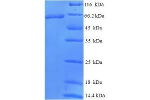 SDS-PAGE (SDS) image for Wilms Tumor 1 (WT1) (AA 1-449), (full length) protein (His-SUMO Tag) (ABIN5710628)