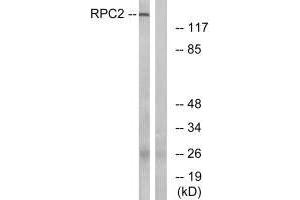 Western blot analysis of extracts from LOVO cells, using RPC2 antibody. (POLR3B 抗体)