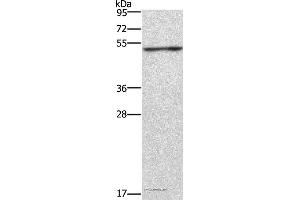 Western blot analysis of Jurkat cell, using CKMT2 Polyclonal Antibody at dilution of 1:700 (CKMT2 抗体)
