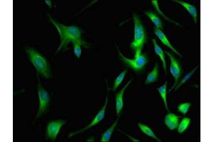Immunofluorescence staining of Hela cells with ABIN7147944 at 1:66, counter-stained with DAPI. (Clusterin 抗体  (AA 23-224))