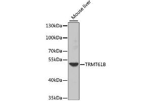 Western blot analysis of extracts of mouse liver, using TRMT61B antibody. (TRMT61B 抗体  (AA 1-250))