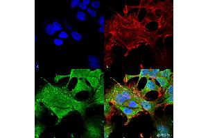 Immunocytochemistry/Immunofluorescence analysis using Mouse Anti-Notch1 Monoclonal Antibody, Clone S253-32 . (Notch1 抗体  (AA 20-216) (PerCP))