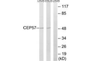 Western blot analysis of extracts from COLO/LOVO cells, using CEP57 Antibody. (CEP57 抗体  (AA 241-290))