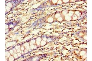 Immunohistochemistry of paraffin-embedded human colon tissue using ABIN7157727 at dilution of 1:100 (KLF4 抗体  (AA 30-230))