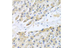 Immunohistochemistry of paraffin-embedded human liver using CCL3 antibody at dilution of 1:100 (40x lens). (CCL3 抗体)