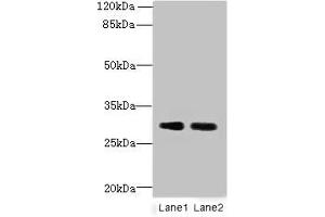 Western blot All lanes: DNALI1 antibody at 1 μg/mL Lane 1: Mouse gonadal tissue Lane 2: Mouse lung tissue Secondary Goat polyclonal to rabbit IgG at 1/10000 dilution Predicted band size: 30, 16 kDa Observed band size: 30 kDa (DNALI1 抗体  (AA 1-258))