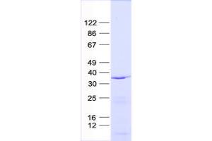 Western Blotting (WB) image for Solute Carrier Family 25 (Mitochondrial Carrier, Adenine Nucleotide Translocator), Member 31 (SLC25A31) protein (His tag) (ABIN2732162)