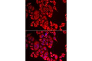 Immunofluorescence analysis of MCF-7 cell using QPCT antibody. (QPCT 抗体)