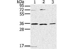 Western blot analysis of SP20, Raji and 231 cell, using IL22RA2 Polyclonal Antibody at dilution of 1:200 (IL22RA2 抗体)