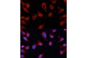 Immunofluorescence analysis of HeLa cells using Caspase-8 antibody (ABIN6131531, ABIN6137971, ABIN6137973 and ABIN6215162) at dilution of 1:100. (Caspase 8 抗体)