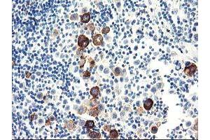 Immunohistochemistry (IHC) image for anti-Dipeptidylpeptidase 10 (DPP10) antibody (ABIN1497834) (DPP10 抗体)