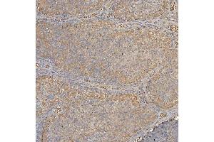 IHC analysis of SLC25A24 using anti-SLC25A24 antibody (ABIN7599228).