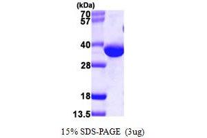 SDS-PAGE (SDS) image for 2,4-Dienoyl CoA Reductase 1, Mitochondrial (DECR1) (AA 35-335) protein (His tag) (ABIN7279383) (DECR1 Protein (AA 35-335) (His tag))