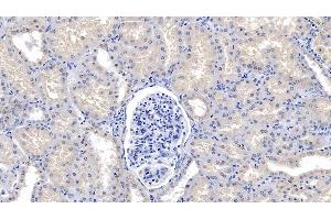 Detection of LY96 in Human Kidney Tissue using Polyclonal Antibody to Lymphocyte Antigen 96 (LY96) (LY96 抗体  (AA 19-130))