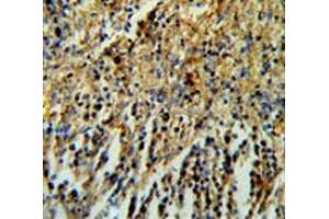Immunohistochemistry analysis in human spleen tissue (Formalin-fixed, Paraffin-embedded) using PHTNS  Antibody  (N-term), followed by peroxidase conjugation of the secondary antibody and DAB staining. (KIAA1949 抗体  (N-Term))