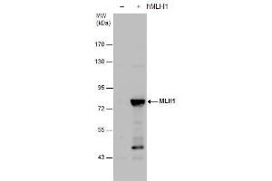 WB Image MLH1 antibody detects MLH1 protein by western blot analysis. (MLH1 抗体)