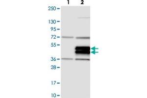 Western blot analysis of Lane 1: Negative control (vector only transfected HEK293T lysate). (TRIML2 抗体)