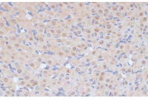 Immunohistochemistry of paraffin-embedded Rat ovary using CDK9 Polyclonal Antibody at dilution of 1:100 (40x lens). (CDK9 抗体)