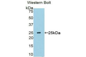 Western blot analysis of the recombinant protein. (SOSTDC1 抗体  (AA 24-206))
