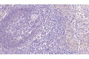 Detection of SIGLEC7 in Human Spleen Tissue using Monoclonal Antibody to Sialic Acid Binding Ig Like Lectin 7 (SIGLEC7) (SIGLEC7 抗体  (AA 18-353))