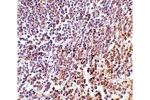 Immunohistochemistry (IHC) image for anti-Lymphocyte Antigen 86 (LY86) (C-Term) antibody (ABIN1030512) (LY86 抗体  (C-Term))