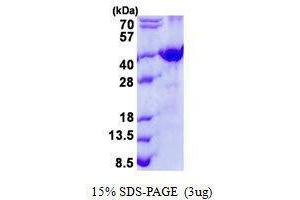 Figure annotation denotes ug of protein loaded and % gel used. (FRZB 蛋白)