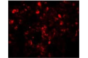 Immunofluorescence of Translin in human lung tissue with Translin antibody at 20 µg/ml. (Translin 抗体  (C-Term))