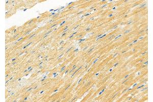 ABIN6263312 and ABIN6266806 at 1/100 staining Rat heart tissue by IHC-P. (Meningioma 1 抗体  (Internal Region))