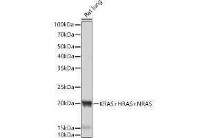 Western blot analysis of extracts of Rat lung, using KRAS+HRAS+NRAS Rabbit mAb (ABIN7267531) at 1:1000 dilution. (GTPase NRas 抗体)