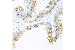 Immunohistochemistry of paraffin-embedded human prostate using LRP5 antibody (ABIN5974915) at dilution of 1/200 (40x lens).