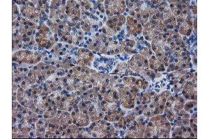 Immunohistochemical staining of paraffin-embedded Human pancreas tissue using anti-DSTN mouse monoclonal antibody. (Destrin 抗体)
