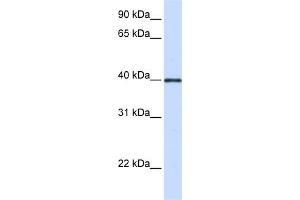 WB Suggested Anti-GP2 Antibody Titration:  0. (GP2 抗体  (Middle Region))