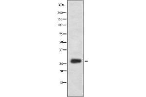 Western blot analysis of FA58A expression in HEK293 cells ,The lane on the left is treated with the antigen-specific peptide. (FAM58A 抗体  (Internal Region))