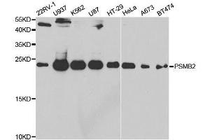 Western blot analysis of extracts of various cell lines, using PSMB2 antibody. (PSMB2 抗体  (AA 1-201))