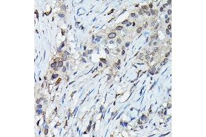 Immunohistochemistry (IHC) image for anti-Chromosome 9 Open Reading Frame 72 (C9ORF72) (AA 1-230) antibody (ABIN7266391)