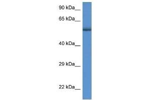 Western Blot showing GBA antibody used at a concentration of 1 ug/ml against MDA-MB-435S Cell Lysate (GBA 抗体  (C-Term))